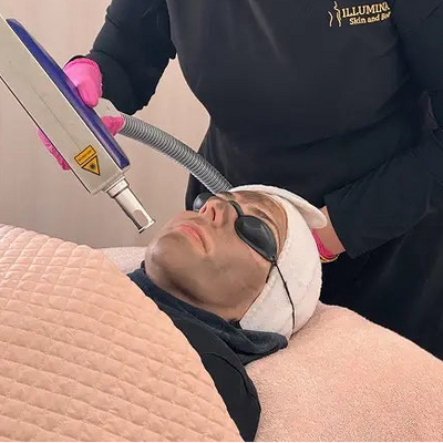 China Doll Carbon Facial
